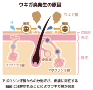 ワキガ臭発生の原因とアポクリン汗腺